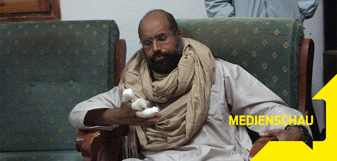 Medienschau: Abgetrennte Finger