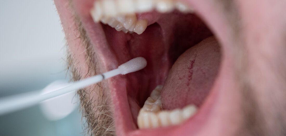 Porträt: Türkenfeind des Tages: DNA-Test