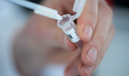 Längst werden DNA-Untersuchungen bei Ermittlungen angewandt, wie...