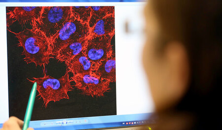 Wo Computerunterstützung nützlich ist: Medizinische Diagnostik Wo Computerunterstützung nützlich ist: Medizinische Diagnostik