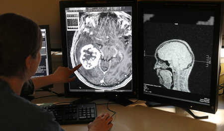 Nichtärztliche Bereiche wie z. B. die Radiologie sollen am Klini...