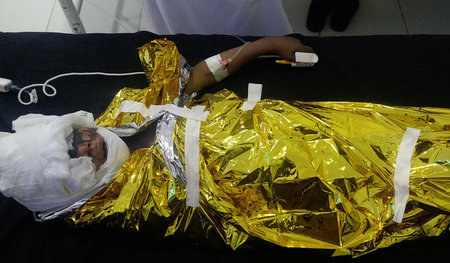 Opfer von US-Aggression: Verwundeter Junge nach Luftangriff in d...