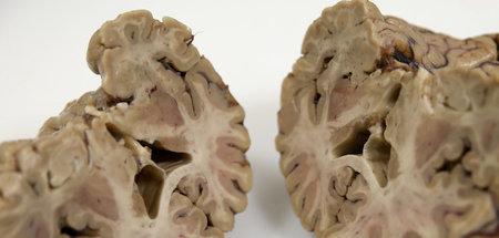 Wird Gerstenberg sich womöglich dem ernsten Fach zuwenden?