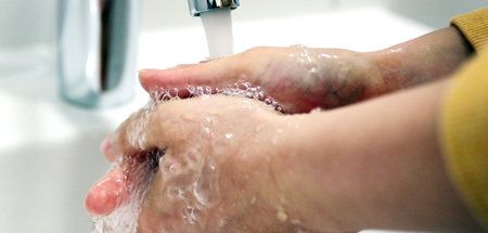 Bis zu 20 Prozent der kreisrunden Haarausfälle könnten so verhin... Bis zu 20 Prozent der kreisrunden Haarausfälle könnten so verhin...