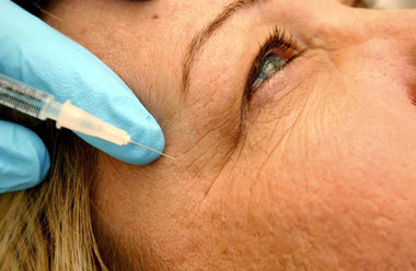 Nebenwirkungen können verschwiegen werden: Das Nervengift Botox ... Nebenwirkungen können verschwiegen werden: Das Nervengift Botox ...