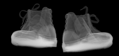Erkennungszeichen des Proletariats? Nein, »X-ray Fashion Bumper ...