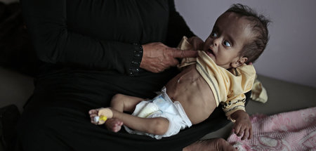 Hungersnot_im_Jemen_67276663.jpg