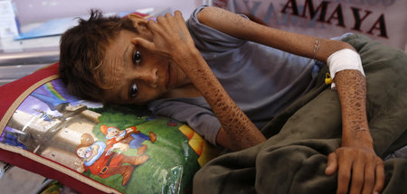 Die Angriffe Saudi-Arabiens führten zu einer Hungersnot im Land