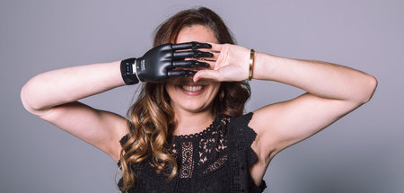 Natalie Nußbaum hat eine Armprothese und ist Fotomodel: »Body Po...