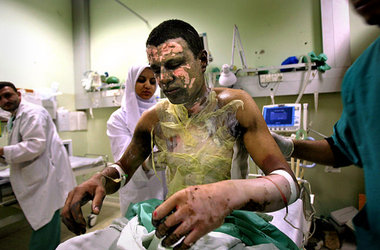 Von weißem Phosphor verbrannt: Palästinenser im Nasser-Krankenha... Von weißem Phosphor verbrannt: Palästinenser im Nasser-Krankenha...