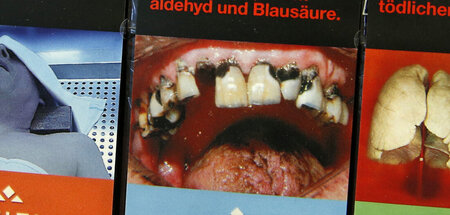 Wohin man auch blickt: faule Zähne und Lungen­karzinome