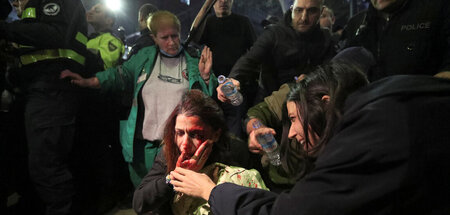 In Georgien keine Seltenheit: Gewalt bei Anti-LGBTQ-Protesten, h...