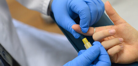 Zahl_der_HIV_Neuinfe_79207207.jpg