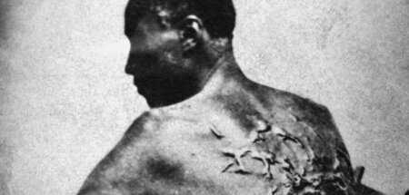 Gefolterter Afroamerikaner mit Peitschennarben (1863)