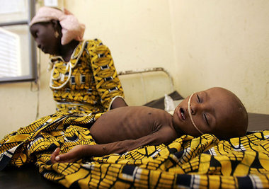 Hospital in Maradi im Süden des Niger: Ärzte kämpfen um das Lebe...