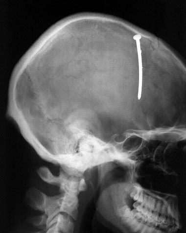 Nagel auf den Kopf getroffen: Gesundheitsschutz gilt auch in der...