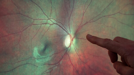 KI-Bild einer Netzhaut und Finger