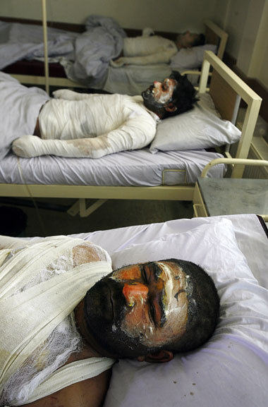 Überlebende des NATO-Bombardements im Krankenhaus in Kabul (5. S...