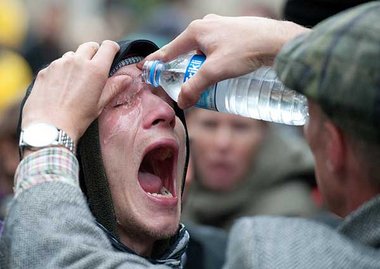 Das ging ins Auge: Opfer des Einsatzes von Pfefferspray. Der pol...