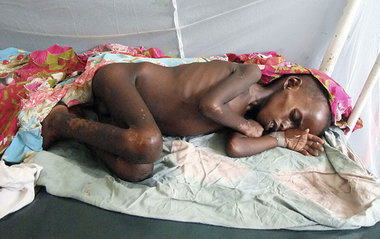Jean Ziegler: &raquo;Ein Kind, das heute verhungert, wird ermord...