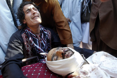 Ayoub Khan aus Laghman, Afghanistan, am 1. Mai 2012 mit der Leic... Ayoub Khan aus Laghman, Afghanistan, am 1. Mai 2012 mit der Leic...