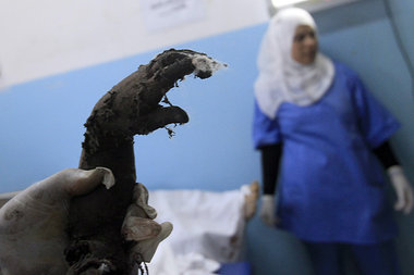 Im Krankenhaus von Surman, westlich von Tripolis am 20. Juni 201...