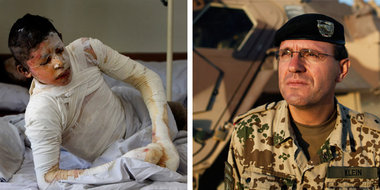 Ein Überlebender des NATO-Angriffs im Krankenhaus in Kabul (5.9....