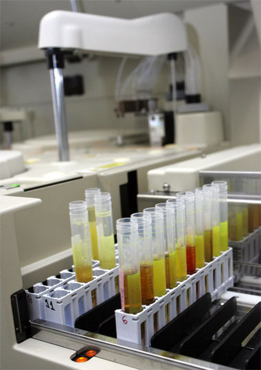 Nicht im juristischen Nirwana: Dopingproben