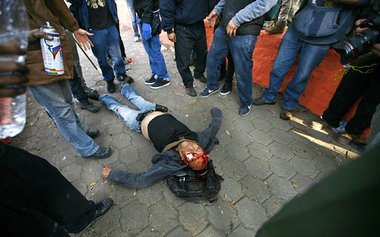 Von einer Tränengasgranate getroffener Demonstrant in Mexiko-Sta...