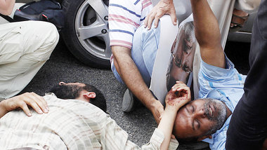 Bei Straßenkämpfen verletzte Mursi-Anhänger am F... Bei Straßenkämpfen verletzte Mursi-Anhänger am F...
