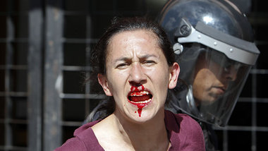Mexiko-Stadt am Sonntag: Ein blutender Demonstrant wird von eine...