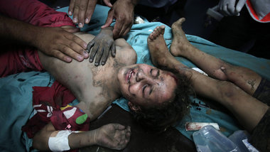Durch einen israelischen Angriff verletztes Mädchen am Mitt... Durch einen israelischen Angriff verletztes Mädchen am Mitt...