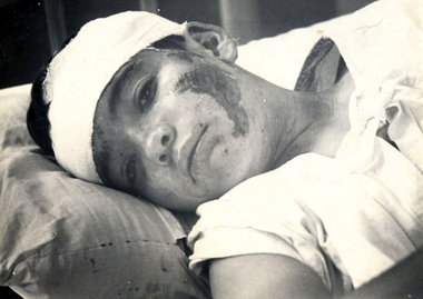 Ein Opfer des Kaufhausanschlags in Havanna von 1960