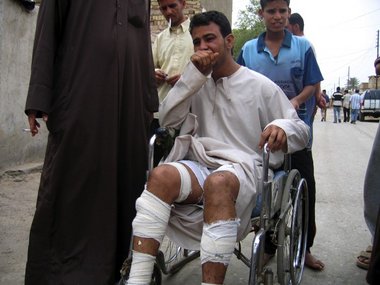 Aus dem Krankenhaus entlassen: Hassan Abed Ali (28) verlor vier ...