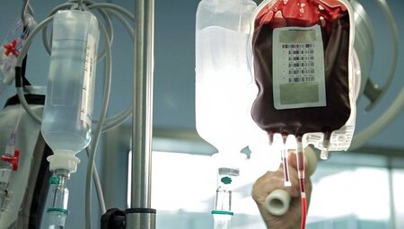 Gefährlicher, als man bislang dachte: Bluttransfusionen