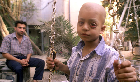 Ali Hamed, 10, aus Basra leidet unter Leukämie (Mai 2001). Berei...