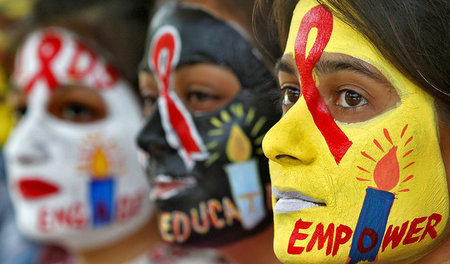 HIV-Infizierte werden weltweit noch immer stark benachteiligt. H... HIV-Infizierte werden weltweit noch immer stark benachteiligt. H...