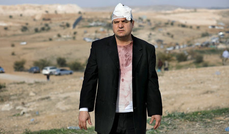 Verwundeter Parlamentarier: Ayman Odeh von der progressiven »Gem...