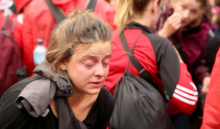 Eine Demonstrantin in Hamburg nach dem Einsatz von Pfefferspray ... Eine Demonstrantin in Hamburg nach dem Einsatz von Pfefferspray ...