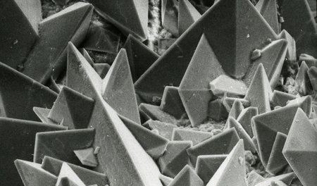 Oberfläche eines ­Nierensteins, an dem sich ein Weddellitkristal...