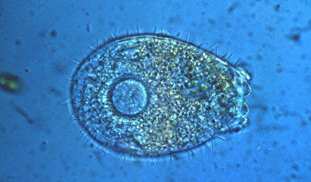 Eine Schalenamöbe ­unter dem Mikroskop